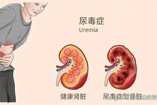 此前因伤连续缺阵六场！欧文将在今天对阵76人时复出